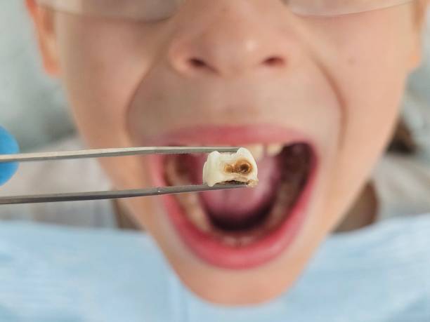 Best Emergency Gum Treatment in La Grange, IL